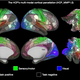 The 180 areas identified in both left and right hemispheres. (Matthew F. Glasser et al., 2016/Nature)